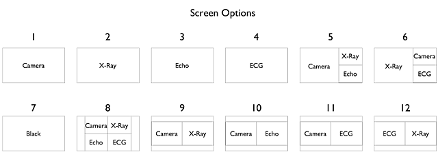 screen options